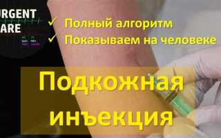 Комплект для инжекции что это