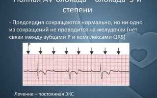 Что такое блок аф ае