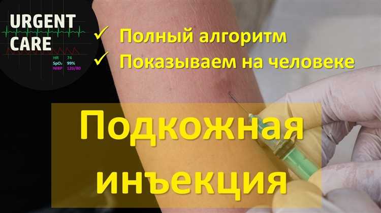 Особенности введения инъекций разными способами